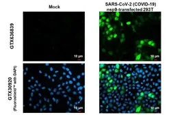 Anti-SARS-CoV-2 (COVID-19) nsp9 antibody [HL1399] used in Immunocytochemistry/ Immunofluorescence (ICC/IF). GTX636839